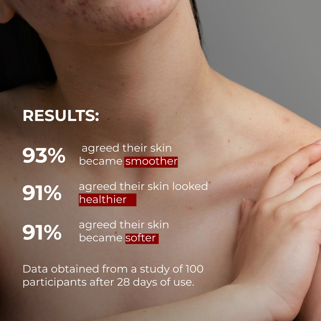 Complex pentru corp împotriva acneei cu acid salicilic Hillary Anti-Acne Body Care Complex with Salicylic Acid