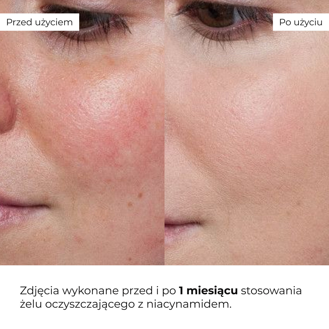 Gel de curățare și echilibrare pentru față cu niacinamidă Hillary Niacinamide Balance Cleansing Gel, 100 ml