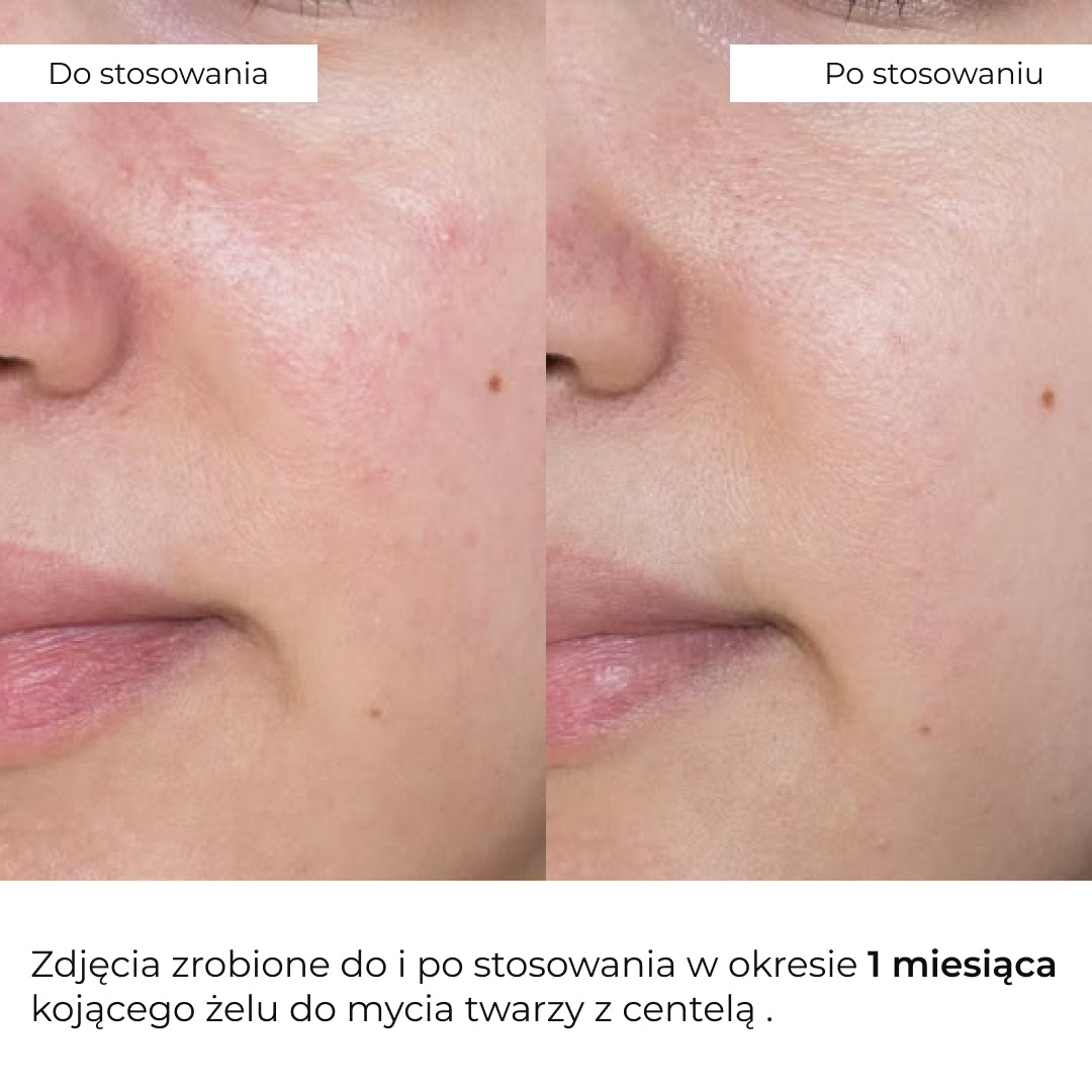 Gel calmant de curățare pentru  față cu centella Hillary Centella Soothing Cleansing Gel, 100 ml